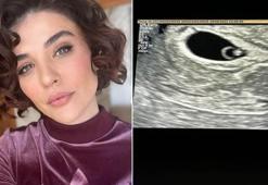 Gonca Vuslateri, bebeğinin ultrason görüntüsünü paylaştı