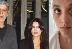 Ozan Güven günler sonra evden çıktı! Böyle görüntülendi