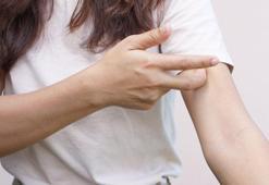 Uyuz vakalarıyla ilgili korkutan açıklama geldi! Defalarca bulaşabiliyor, tek çaresi var