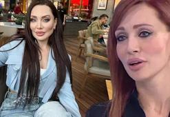 Yerli Angelina Jolie Umut Akyürek son yaptırdığı estetikle şaşırttı