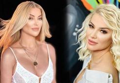 Songül Karlı'nın gözünün son hali görenleri şaşırttı!