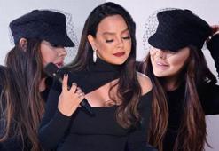 Ebru Gündeş'in yüzündeki değişim ‘estetik’ yorumlarına neden oldu!