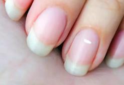 Tırnak Uzatma Kürü Tarifi İle Zayıflama Önerileri...tırnak Uzatma Kürü Nasıl Yapılır, Nasıl Kullanılır?