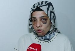 Eski eşinin ailesi tarafından sokak ortasında dövülen kadının yardım çağrısı! Kan donduran olay