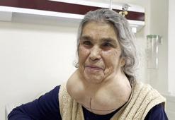 Doktordan korktuğu için 50 yıl böyle yaşadı! Ameliyat sonrası sözleri şaşırttı