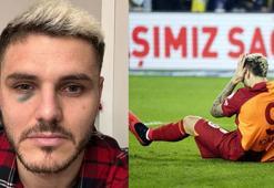 Galatasaray, Icardi'nin morluğunu paylaştı! Fenerbahçe ve Dzeko'dan yanıt gecikmedi