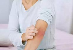 Gece Kaşıntısı Nasıl Geçer? Gece Kaşıntısı Geçiren Yöntemler, Püf Noktaları Nelerdir?