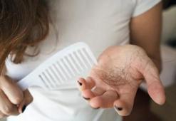 Saçlar inceldiği yerden kopmuyor! Sadece iki malzeme var: Saç döküldüğü yerden tekrar bitiyor!