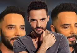 Yeni görüntüsü çok konuşulmuştu! Gökhan Özen'den estetik açıklaması: Benim keyfimi böyle kaçıramazsınız!