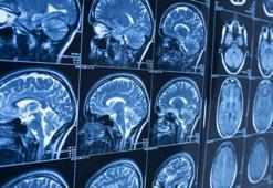 Beyniniz ne durumda: Bu test beyninizin kapasitesini ölçüyor!