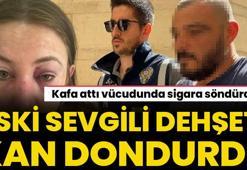 Kafa attı vücudunda sigara söndürdü! Eski sevgili dehşeti kan dondurdu
