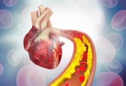 50 gramı kalbinizi saat gibi işletiyor! Bu formül, yüksek kolesterolü düşürmek için, düşük yoğunluklu lipoprotein (LDL) düzeylerini azaltmaya yardımcı oluyor!