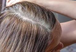 Saçlarınız yaş aldıkça beyazlaşmıyor: Yemeklerden bunları eksik etmeyin, sebum üretimi durmasın!