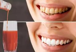 Sigara ve çaydan sararan dişleri bembeyaz yapıyor: Karışımın malzemeleri mutfağınızda var!