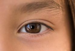 Son ana kadar farkedilmeyen hastalık: Glokom