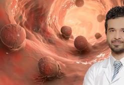 Kolon kanseri riski artıyor! Yakalanmamak için yapılması gerekenleri uzman isim açıkladı