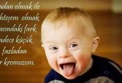 Down Sendromu Günü sözleri ||  Anlamlı Down Sendromu farkındalık günü ile ilgili sözler: 21 Mart Down Sendromu Farkındalık günü mesajları