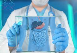 Kalın bağırsak can almaya devam ediyor! Dünyada 1 milyon kişi etkilendi