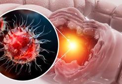 Her yıl 1 milyon kişiyi etkiliyor! Ölümcül tehdit kansızlıkla ortaya çıkıyor, uzman isim tek tek sıraladı