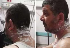 Ev sahibi dehşeti: Kiracısının yüzüne asit döktü!