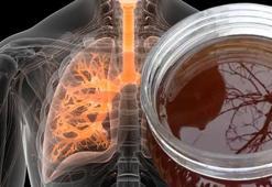 Sadece Adana'da üretiliyor! Akciğer hastalıkları dahil her derde deva oluyor