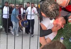 Kavgada yüzüne tekme geldi! Dili boğazına kaçtı