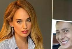 Seda  Bakan da dişsiz halini paylaştı!