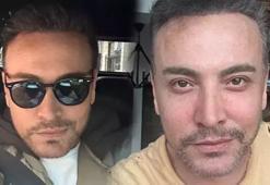 Estetikli ünlüler kervanına katılan Cenk Eren'den üzen haber!