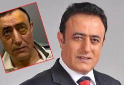 Mahmut Tuncer estetik yaptırdı! ‘Mahmut El Roman’