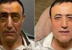 Estetikli ünlüler kervanına katılan Mahmut Tuncer: Ivana geleceği görmüş!