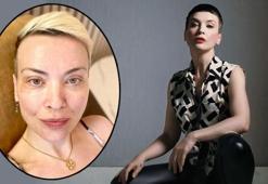 Verdiği kilolar dikkat çekti! 46 yaşındaki Arzu Yanardağ ‘Her gün 3-4 litre su içiyorum’ dedi