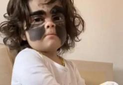 Yüzündeki leke yüzünden lanetli deniyordu! Küçük kızın şimdiki haline bir bakın!