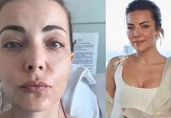 Beyin ameliyatı olmuştu! Burcu Kara ailesiyle yurt dışına tatile çıktı