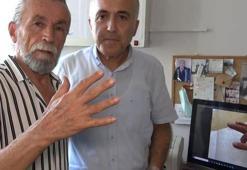 Adana'da 'Tetik parmak sendromu'nu iyileştiren bitkisel karışım geliştirdi! 12 farklı hastada iyileşme sağladı