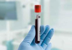 Adana'yı karıştıran olay: Trans bireyin HIV sonucu pozitif çıktı