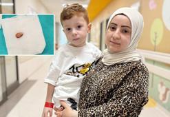 3 yıl boyunca denemediği tedavi kalmamıştı, nefes borusundan çıktı! Doktorları bile şaşırtan vaka