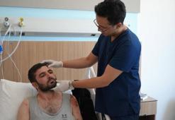 Gaziantep'te bacağından alınan dokuyla yeni yüzüne kavuştu