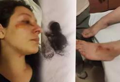 Bursa'da kedi dayağı: Besledikleri kediyi öldüren baba- oğul tarafından darp edildi!