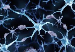 Avrupa Birliği Alzheimer hastalarına derman olacak ilaca onay vermedi! Bilişsel zayıflamayı yüzde 25 oranında yavaşlatıyor