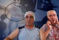 Yolcu şoförü 9 yerinden ısırdı, kulağını kopardı! o anlar saniye saniye kayıtlarda