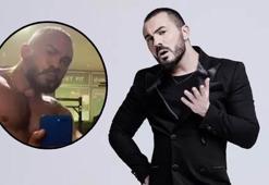 Değişimi şaşırtmıştı! Rober Hatemo yüzüne yaptırdığı işlemi açıkladı