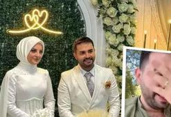 Kadir Ezildi'nin nişanlısına sürpriz yaptı, aldığı tepki şaşırttı!