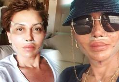 Serap Paköz estetik yaptırıp 'yaptırmadım' diyenleri hedef aldı!