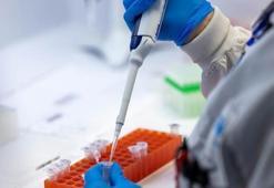 Mpox virüsü nedir, Mpox belirtileri neler? Mpox salgını nasıl bulaşır?