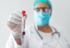 Afrika’da maymun çiçeği virüsü tehlikesi! "Halk sağlığı acil durumu" ilan edildi