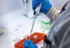 Sağlık Bakanlığı'ndan maymun çiçeği virüsü açıklaması: Hastalık için tanı rehberi hazırlandı