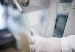 "İstanbul'da bir kişi M çiçeği şüphesiyle karantinaya alındı" iddiası yalanlandı