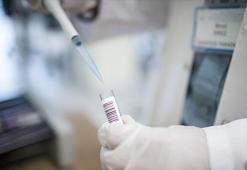 Maymun çiçeği virüsü Afrika kıtasının dışına sıçradı! İsveç ilk vakayı doğruladı