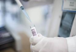 Suçiçeği geçirenler maymun çiçeği olur mu? Suçiçeği aşısı maymun çiçeğinden korur mu?