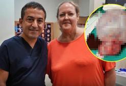 Karnından tam 6 kilo çıktı! Kasık ağrısıyla gitti, doktorlar bile inanamadı